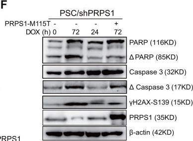 Fig.5.F showing Western Blotting from the publication: PRPS1-mediated purine biosynthesis is critical for pluripotent stem cell survival and stemness.