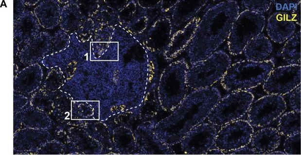Fig.3.A showing Immunohistochemistry-immunofluorescence in a Mus musculus (House mouse) sample from the publication: Spermatogonial fate in mice with increased activin A bioactivity and testicular somatic cell tumours.