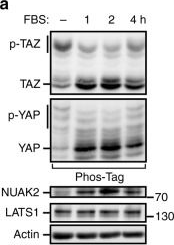 Fig.4.A showing Western Blotting from the publication: A feed forward loop enforces YAP/TAZ signaling during tumorigenesis.