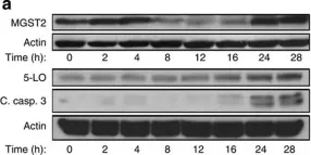 Fig.1.A showing Western Blotting in a Homo sapiens (Human) sample from the publication: Leukotriene C4 is the major trigger of stress-induced oxidative DNA damage.