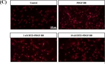 Fig.5.C from the publication: Proteasome inhibitor bortezomib prevents proliferation and migration of pulmonary arterial smooth muscle cells.