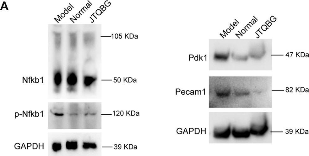 Fig.7.A showing Western Blotting in a Rattus norvegicus (Rat) sample from the publication: The protective effect of traditional Chinese medicine Jinteng Qingbi granules on rats with rheumatoid arthritis.