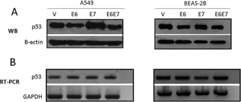 Fig.2.A showing Western Blotting from the publication: Functional interaction between human papillomavirus type 16 E6 and E7 oncoproteins and cigarette smoke components in lung epithelial cells.