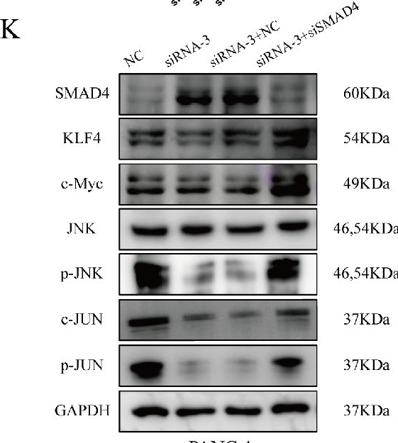 Fig.5.K showing Western Blotting in a Homo sapiens (Human) sample from the publication: LINC00909 up-regulates pluripotency factors and promotes cancer stemness and metastasis in pancreatic ductal adenocarcinoma by targeting SMAD4.