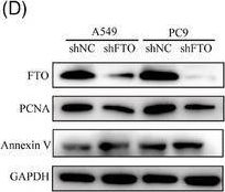 Fig.2.D showing Western Blotting in a Homo sapiens (Human) sample from the publication: FTO-mediated m6A demethylation regulates IGFBP3 expression and AKT activation through IMP3-dependent P-body re-localisation in lung cancer.