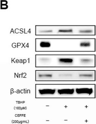 Fig.4.B showing Western Blotting from the publication: Cell-Free Fat Extract for the Treatment of Lumbar Disc Degeneration: A Novel Approach Using Adipose-Derived Biologic.
