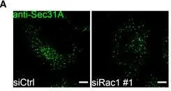 Fig.3.A showing Immunocytochemistry-immunofluorescence from the publication: Mechanical strain stimulates COPII-dependent secretory trafficking via Rac1.
