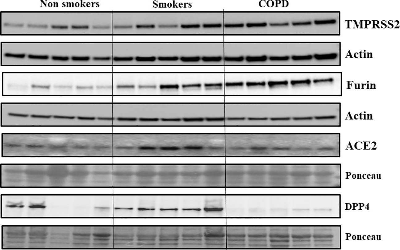 DPP4 antibodies - Antibody search engine - CiteAb