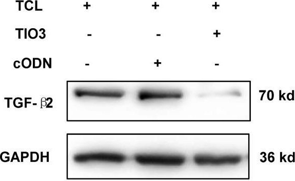 TGFB2 antibodies - Antibody search engine - CiteAb