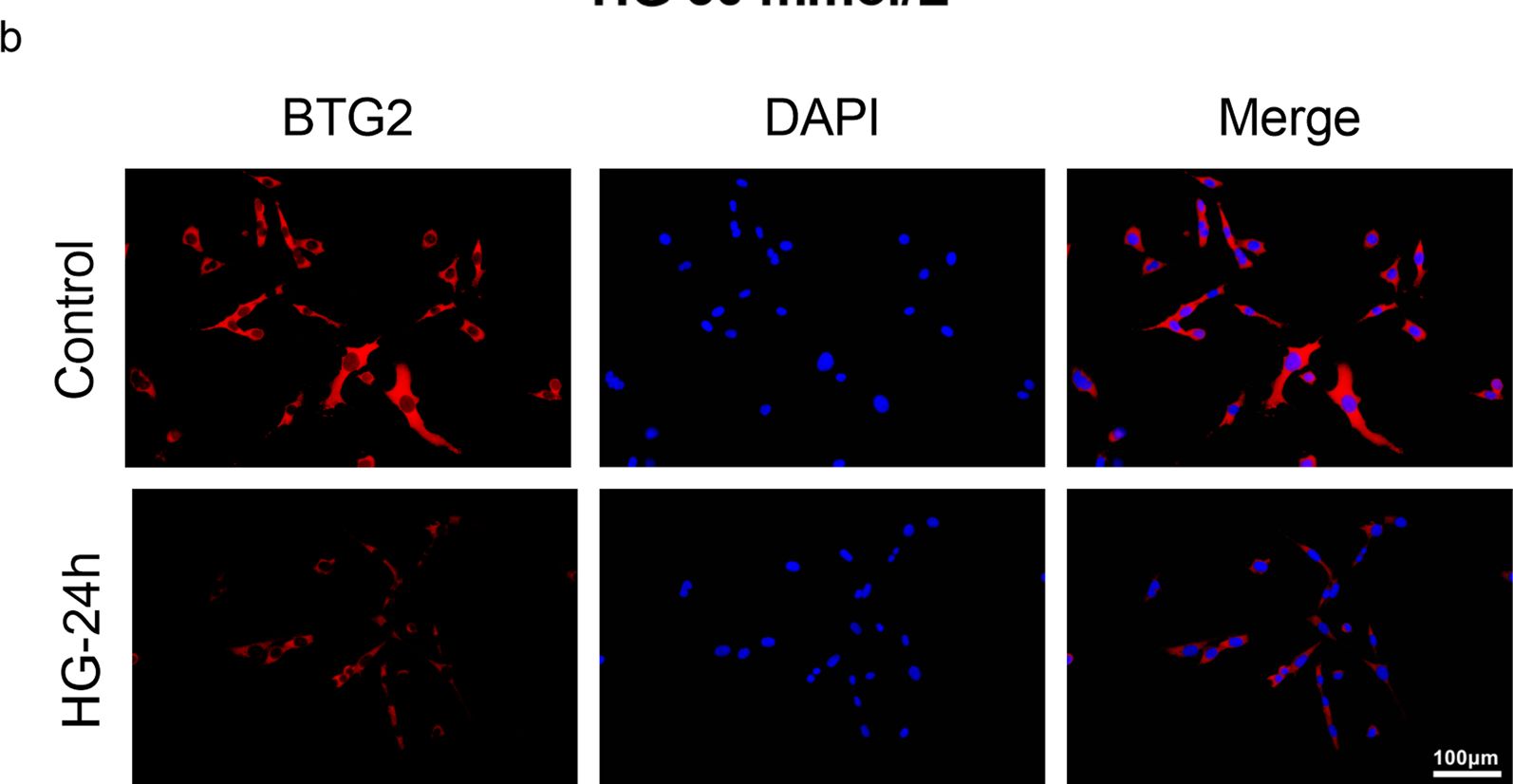 Fig.5.B showing Immunocytochemistry-immunofluorescence in a Mus musculus (House mouse) sample from the publication: Deciphering the molecular nexus of BTG2 in periodontitis and diabetic kidney disease.