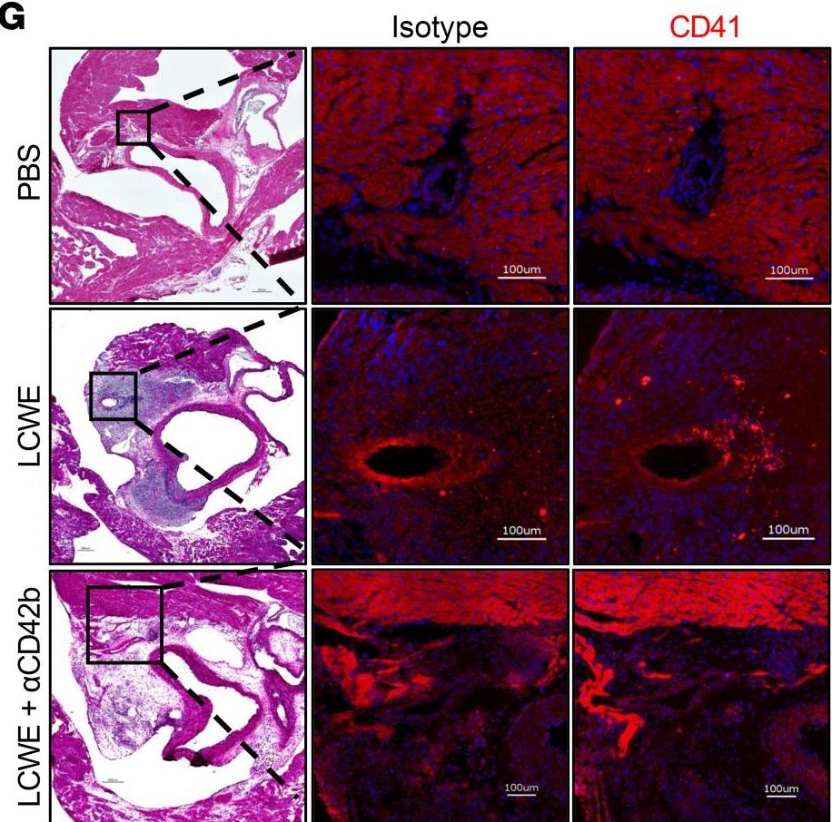 Fig.3.G showing Immunohistochemistry-immunofluorescence in a Mus musculus (House mouse) sample from the publication: Platelets exacerbate cardiovascular inflammation in a murine model of Kawasaki disease vasculitis.