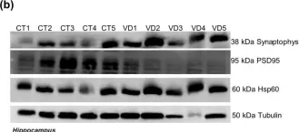 Fig.15.B showing Western Blotting from the publication: Differential protein expression in diverse brain areas of Parkinson's and Alzheimer's disease patients.