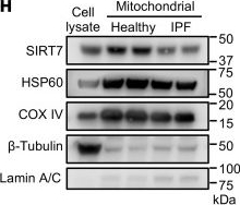 Fig.4.H showing Western Blotting from the publication: Activation of the impaired NAMPT/SIRT7/SOD2 axis restores alveolar progenitor cell renewal in idiopathic pulmonary fibrosis.