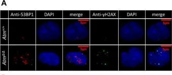 Fig.4.A showing Immunocytochemistry-immunofluorescence from the publication: p38α plays differential roles in hematopoietic stem cell activity dependent on aging contexts.
