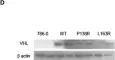 Fig.4.D showing Western Blotting from the publication: VHL-P138R and VHL-L163R Novel Variants: Mechanisms of VHL Pathogenicity Involving HIF-Dependent and HIF-Independent Actions.