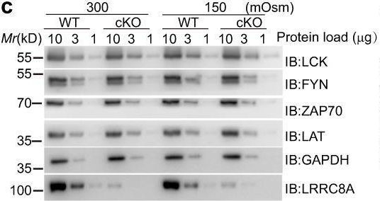 Fig.7.C showing Western Blotting in a Mus musculus (House mouse) sample from the publication: Cell volume controlled by LRRC8A-formed volume-regulated anion channels fine-tunes T cell activation and function.