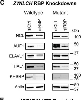 Fig.6.C showing Western Blotting in a Homo sapiens (Human) sample from the publication: Multi-level functional genomics reveals molecular and cellular oncogenicity of patient-based 3' untranslated region mutations.