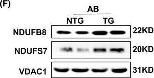 Fig.4.F showing Western Blotting from the publication: HINT2 protects against pressure overload-induced cardiac remodelling through mitochondrial pathways.