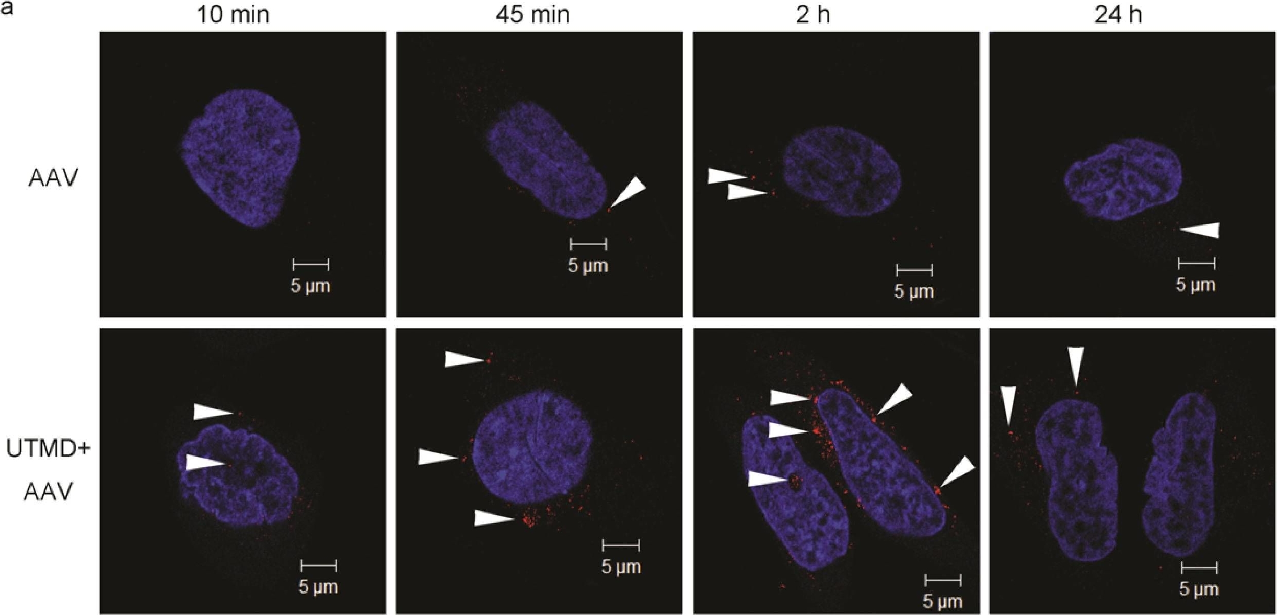 Ultrasound targeted microbubble destruction stimulates cellular endocytosis in facilitation of adeno-associated virus delivery.