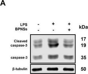 Fig.5.A showing Western Blotting in a Mus musculus (House mouse) sample from the publication: Treatment of Rheumatoid Arthritis Based on the Inherent Bioactivity of Black Phosphorus Nanosheets.