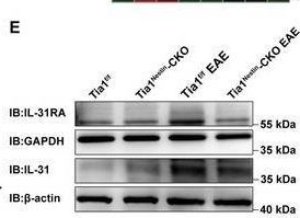 Fig.6.E showing Western Blotting in a Mus musculus (House mouse) sample from the publication: TIA1-Mediated Stress Granules Promote the Neuroinflammation and Demyelination in Experimental Autoimmune Encephalomyelitis through Upregulating IL-31RA Signaling.