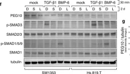 Fig.4.F showing Western Blotting from the publication: TGF-β signalling and PEG10 are mutually exclusive and inhibitory in chondrosarcoma cells.