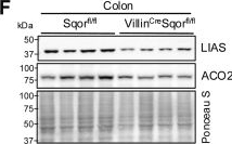 Fig.1.F showing Western Blotting from the publication: Hydrogen sulfide increases intracellular oxygen and inhibits the HIF response.