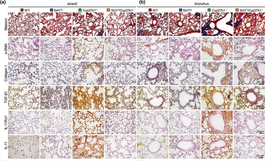 Fig.3.A showing Immunohistochemistry in a Mus musculus (House mouse) sample from the publication: Sirt1 overexpression improves senescence-associated pulmonary fibrosis induced by vitamin D deficiency through downregulating IL-11 transcription.