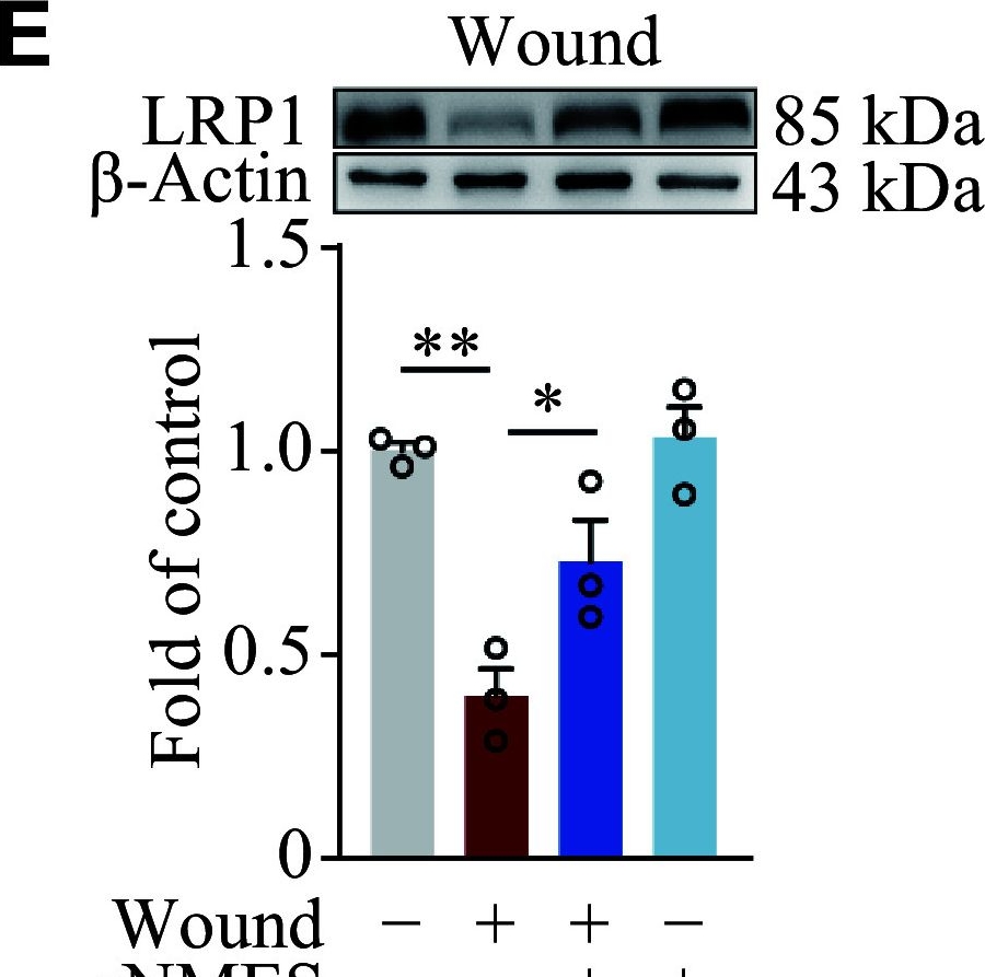 Fig.5.E showing Western Blotting in a Mus musculus (House mouse) sample from the publication: Remote neuromuscular electrical stimulation upregulates MDK to enhance macrophage efferocytosis via LRP1 in wound healing.