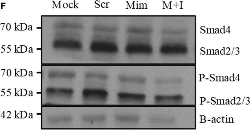 Fig.3.F showing Western Blotting in a Mus musculus (House mouse) sample from the publication: miR-466a Targeting of TGF-β2 Contributes to FoxP3+ Regulatory T Cell Differentiation in a Murine Model of Allogeneic Transplantation.
