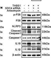 Fig.6.N showing Western Blotting from the publication: THBS1+ Macrophages Exacerbate Modic Changes via SDC4-Dependent Activation of NLRP3 Inflammasome.