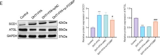 Fig.6.E showing Western Blotting in a Homo sapiens (Human) sample from the publication: FCGBP links hormonal imbalance and hepatic steatosis in PCOS-NAFLD comorbidity: an integrative bioinformatics and experimental study.