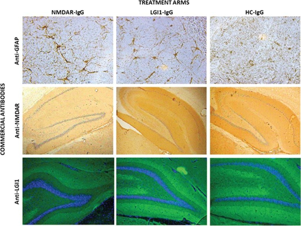 Fig.5.A showing Immunohistochemistry in a Rattus norvegicus (Rat) sample from the publication: Antibody induced seizure susceptibility and impaired cognitive performance in a passive transfer rat model of autoimmune encephalitis.