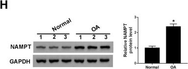 Fig.5.H showing Western Blotting in a Homo sapiens (Human) sample from the publication: Circular RNA circ_0128846 promotes the progression of osteoarthritis by regulating miR-127-5p/NAMPT axis.