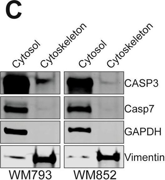 Fig.2.C showing Western Blotting in a Homo sapiens (Human) sample from the publication: Atypical contribution of caspase-3 to melanoma cancer cell motility by regulation of coronin 1B activity.