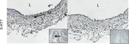Fig.2.A showing Immunohistochemistry in a Rattus norvegicus (Rat) sample from the publication: 5-HT is a potent relaxant in rat superior mesenteric veins.