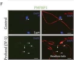 Fig.2.F showing Immunocytochemistry-immunofluorescence from the publication: Discovery of CCDC188 gene as a novel genetic target for human acephalic spermatozoa syndrome.