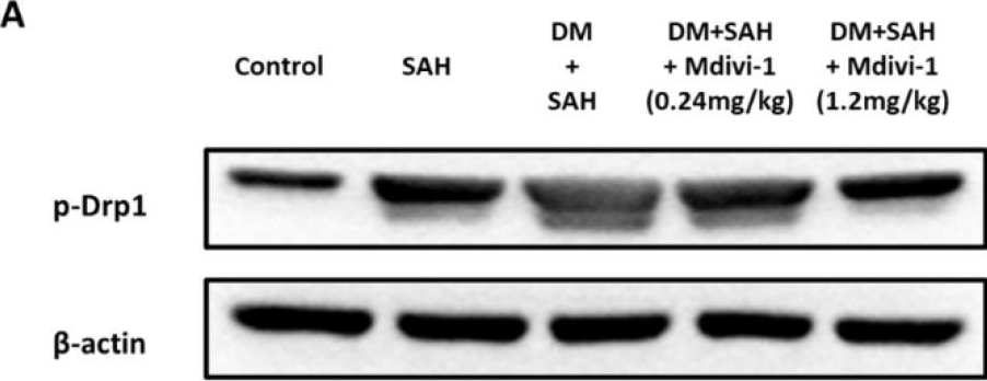 Fig.7.A showing Western Blotting from the publication: Therapeutic Effect of Mitochondrial Division Inhibitor-1 (Mdivi-1) on Hyperglycemia-Exacerbated Early and Delayed Brain Injuries after Experimental Subarachnoid Hemorrhage.