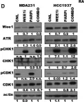 Fig.4.D showing Western Blotting from the publication: Targeting Replicative Stress and DNA Repair by Combining PARP and Wee1 Kinase Inhibitors Is Synergistic in Triple Negative Breast Cancers with Cyclin E or BRCA1 Alteration.