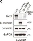 Fig.4.C showing Western Blotting from the publication: ZHX2 deficiency enriches hybrid MET cells through regulating E-cadherin expression.