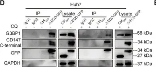 Fig.3.D showing Western Blotting from the publication: Targeting autophagy in HCC treatment: exploiting the CD147 internalization pathway.