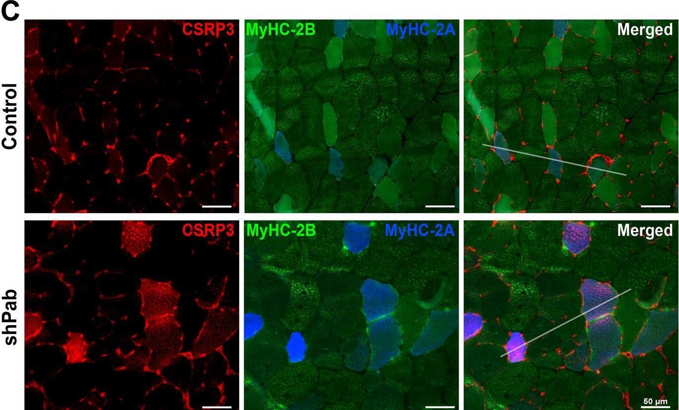 Fig.1.C showing Immunohistochemistry-immunofluorescence from the publication: Cytoskeletal disorganization underlies PABPN1-mediated myogenic disability.