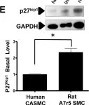 Fig.5.E showing Western Blotting from the publication: MARCKS Signaling Differentially Regulates Vascular Smooth Muscle and Endothelial Cell Proliferation through a KIS-, p27kip1- Dependent Mechanism.