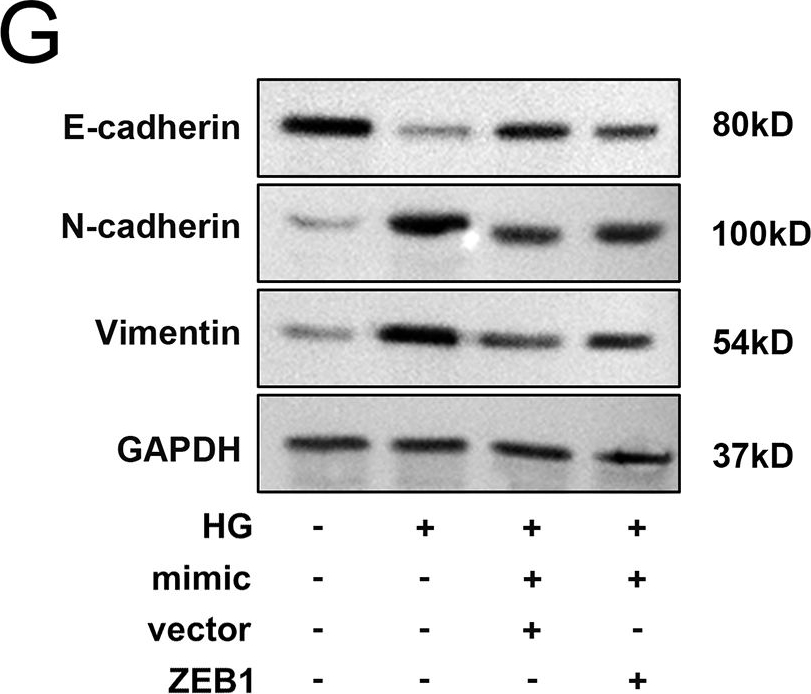 Fig.6.G showing Western Blotting from the publication: Circular RNA FTO functions as a hsa-miR-141-3p sponge to regulate the growth and migration abilities of human retinal endothelial cells via up-regulating ZEB1.
