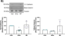 Fig.5.B showing Western Blotting from the publication: Intercellular communication between extracellular vesicles from conditioned macrophages and breast cancer cells drives endocrine therapy resistance.