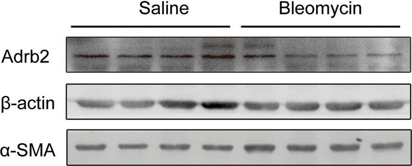 Fig.1.E showing Western Blotting in a Mus musculus (House mouse) sample from the publication: ADRB2 inhibition combined with antioxidant treatment alleviates lung fibrosis by attenuating TGFβ/SMAD signaling in lung fibroblasts.
