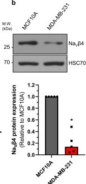 Fig.1.B showing Western Blotting in a Homo sapiens (Human) sample from the publication: The Voltage-Gated Sodium Channel Beta4 Subunit Maintains Epithelial Phenotype in Mammary Cells.