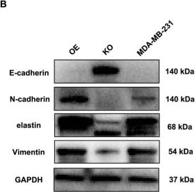 Fig.4.B showing Western Blotting from the publication: Konjac petroleum ether extract inhibits triple-negative breast cancer cell migration and invasion by attenuating OLFML2A-mediated epithelial-mesenchymal transition.
