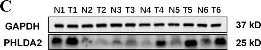 Fig.11.C showing Western Blotting from the publication: Characteristics of lactate metabolism phenotype in hepatocellular carcinoma.