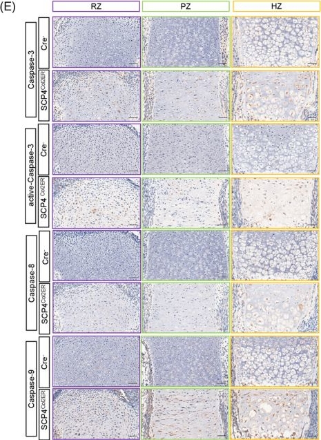 Fig.3.E showing Immunohistochemistry in a Mus musculus (House mouse) sample from the publication: Protein phosphatase SCP4 regulates cartilage development and endochondral osteogenesis via FoxO3a dephosphorylation.